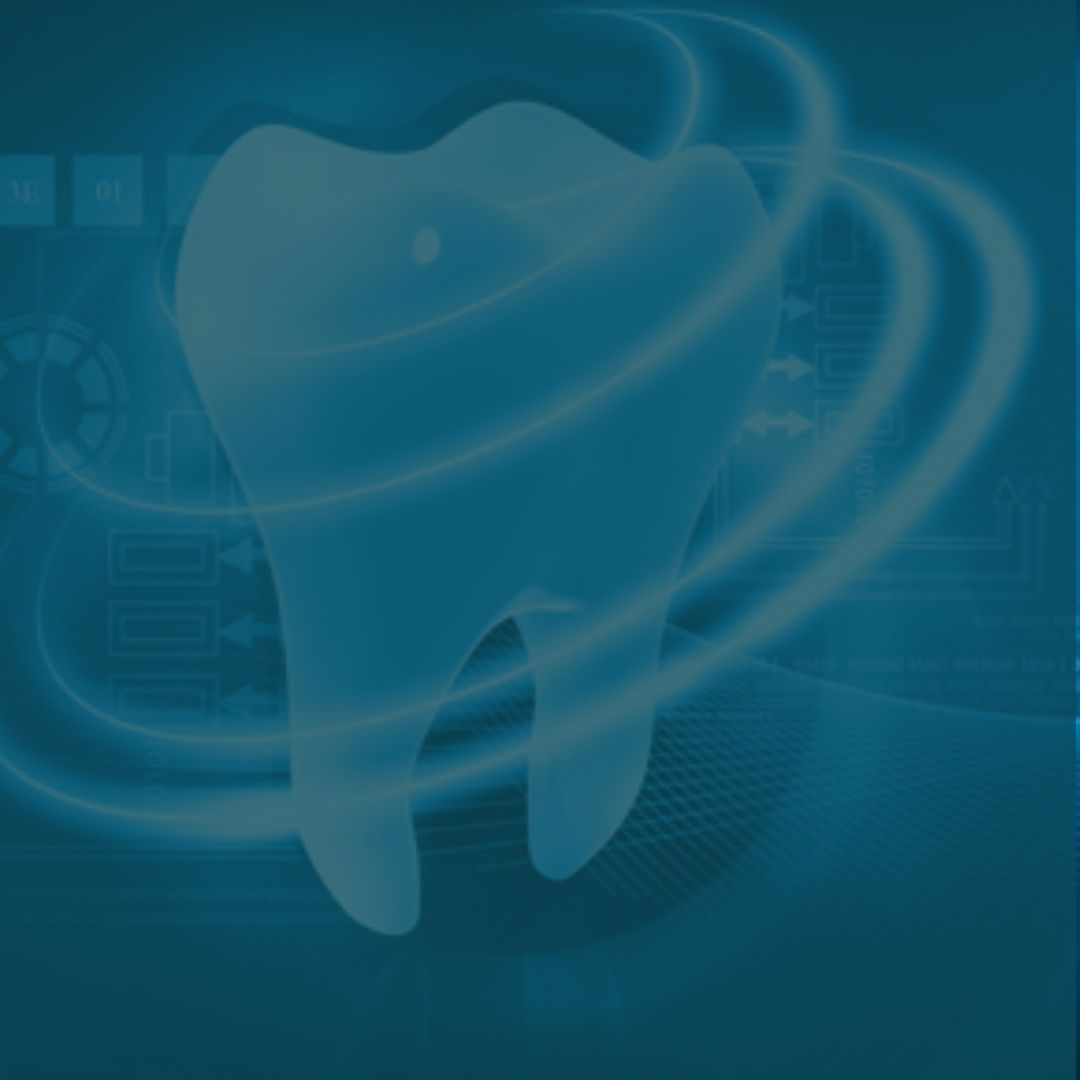 Veneers